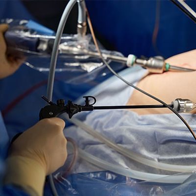 Cirugia-Laparoscopica-Cuenca-Dr-David-Barzallo-min